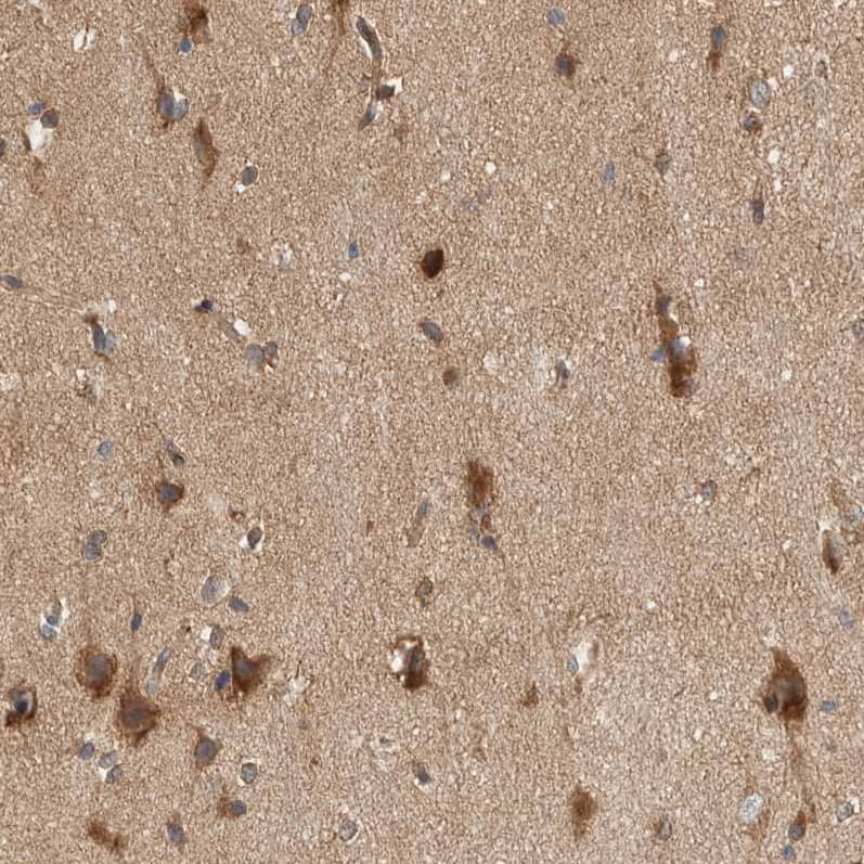 Staining of human cerebral cortex shows strong cytoplasmic positivity in neurons.