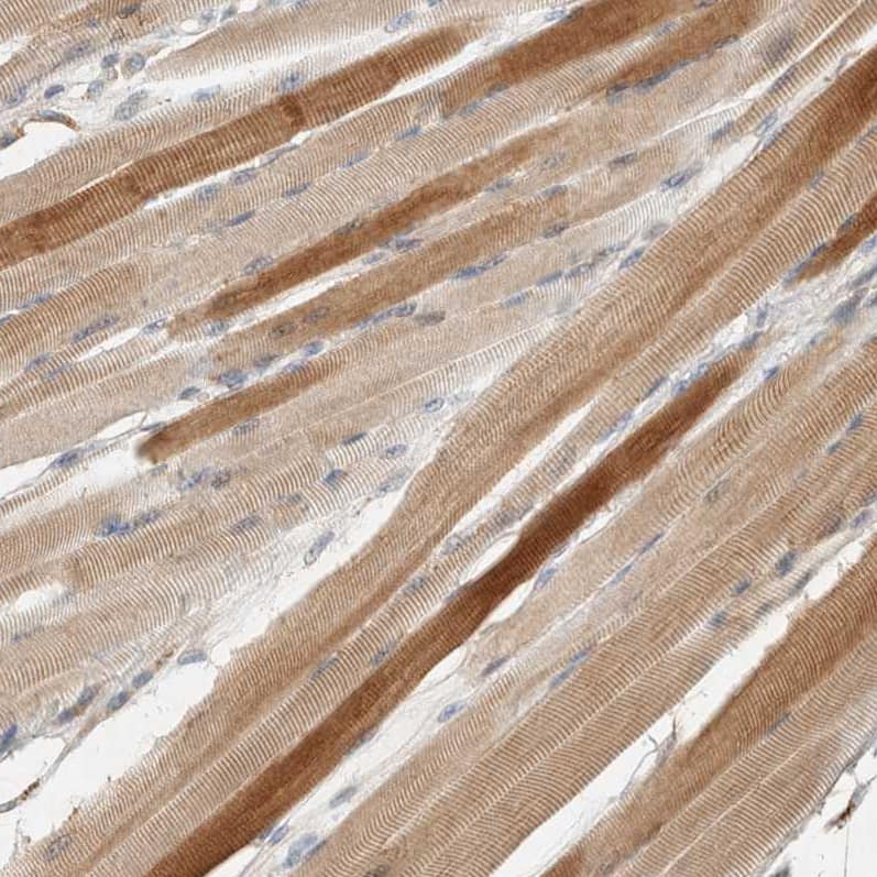 Staining of human skeletal muscle shows moderate cytoplasmic positivity in myocytes.