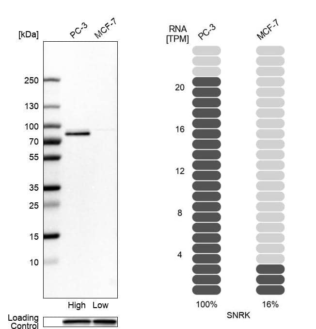 <b>Orthogonal Strategies Validation. </b>Analysis in human cell lines PC-3 and MCF-7 using Anti-SNRK antibody. Corresponding SNRK RNA-seq data are presented for the same cell lines. Loading control: Anti-PPIB.