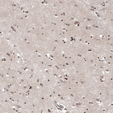 Staining of human cerebral cortex shows moderate nuclear positivity in glial cells.