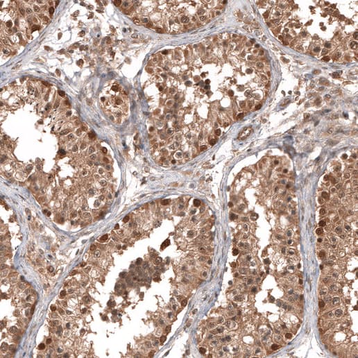 Staining of human testis shows moderate nuclear and cytoplasmic positivity in cells in seminiferous ducts.
