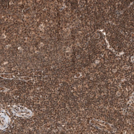 Staining of human tonsil shows moderate nuclear and cytoplasmic positivity in germinal and non-germinal center cells.