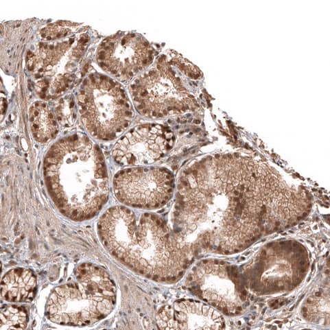 Staining of human small intestine shows moderate nuclear positivity in glandular cells.