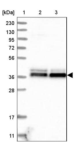 Lane 1: Marker [kDa] 230, 130, 95, 72, 56, 36, 28, 17, 11Lane 2: Human cell line RT-4Lane 3: Human cell line U-251MG sp