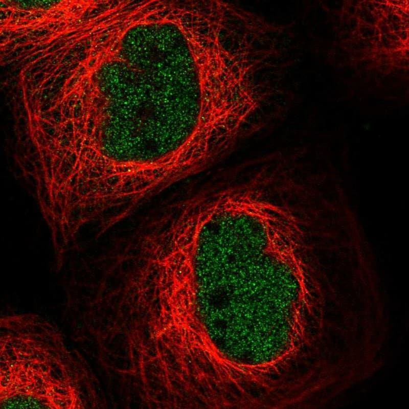 Staining of human cell line A-431 shows localization to nucleoplasm.
