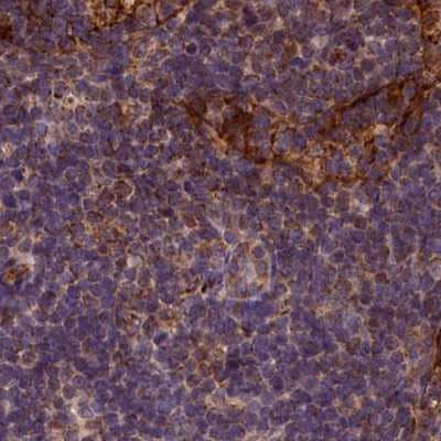Staining of human lymph node.