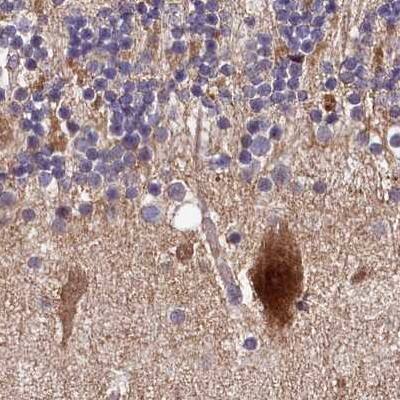 Staining of human cerebellum.