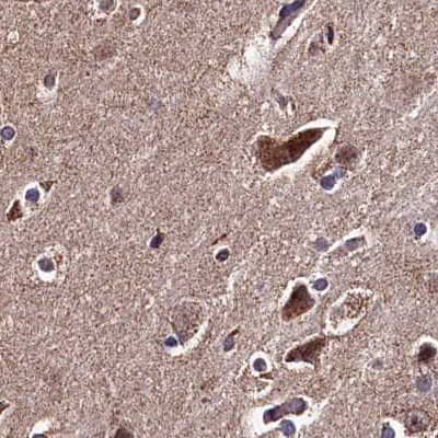 Staining of human cerebral cortex.