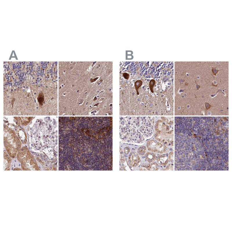 <b>Orthogonal Strategies Validation. </b>Staining of human cerebellum, cerebral cortex, kidney and lymph node HPA039426 (A) shows similar protein distribution across tissues to independent antibody HPA039685 (B).