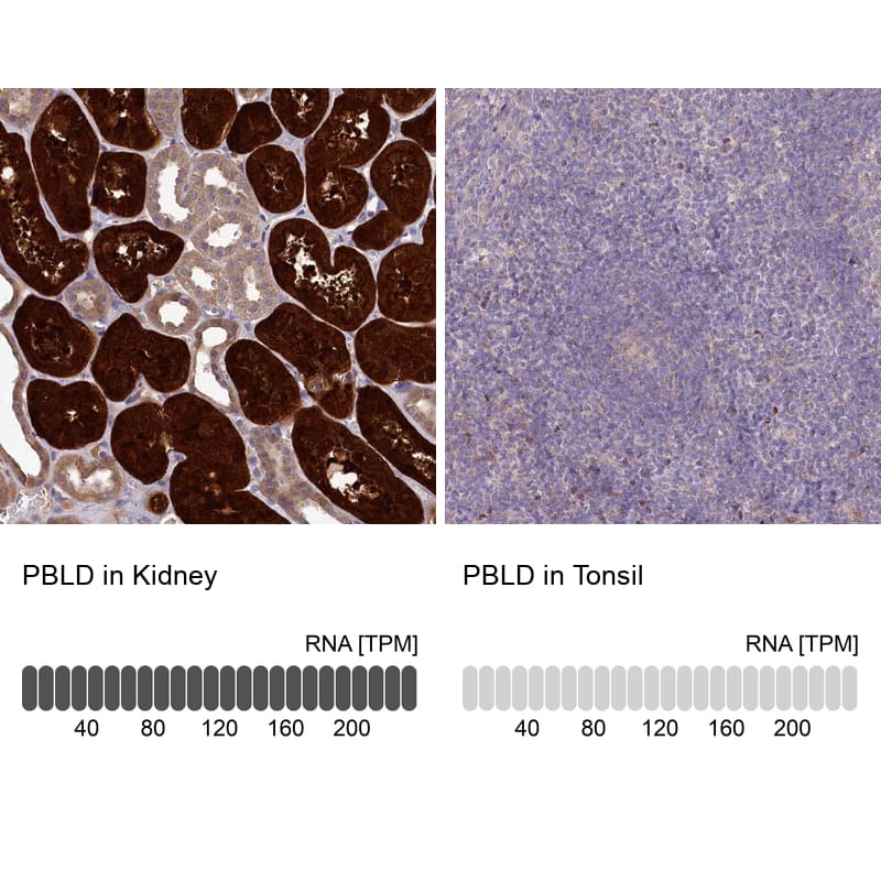 <b>Independent Antibodies Validation and Orthogonal Strategies Validation.</b>Analysis in human kidney and tonsil tissues.