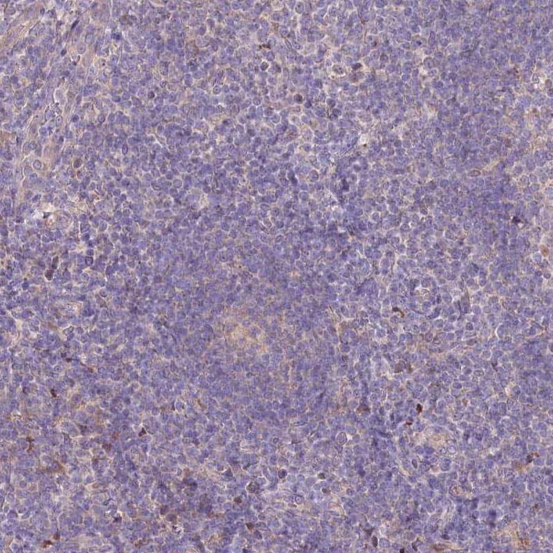 Staining of human tonsil shows low expression as expected.