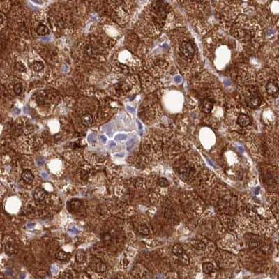 Staining of human liver.