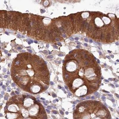 Staining of human colon.