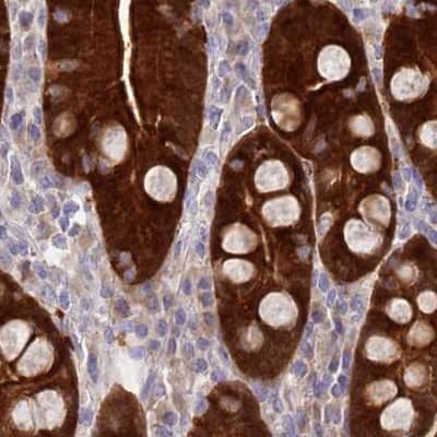 Staining of human duodenum.