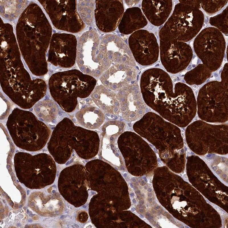 Staining of human kidney shows high expression.
