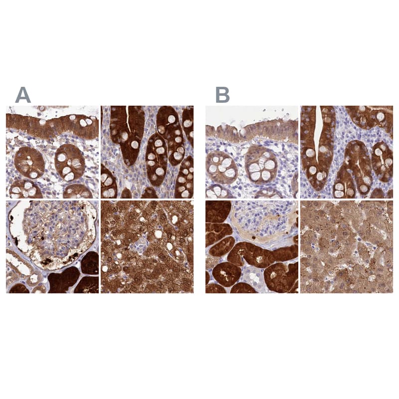 <b>Orthogonal Strategies Validation. </b>Staining of human colon, duodenum, kidney and liver HPA038036 (A) shows similar protein distribution across tissues to independent antibody HPA038035 (B).