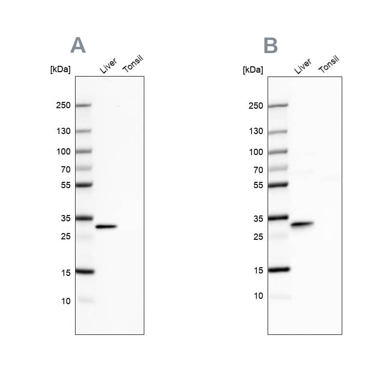 <b>Independent Antibodies Validation. </b>Analysis using Anti-PBLD antibody NBP1-83683 (A) shows similar pattern to independent antibody NBP1-83682 (B).