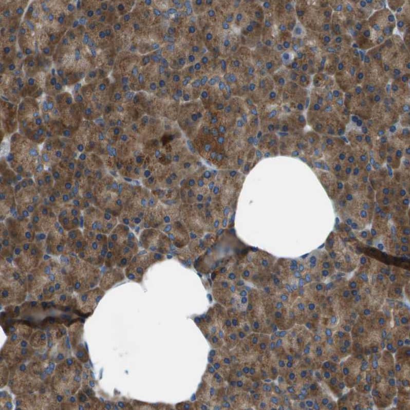 Immunohistochemistry-Paraffin ARFGAP2 Antibody - BSA Free