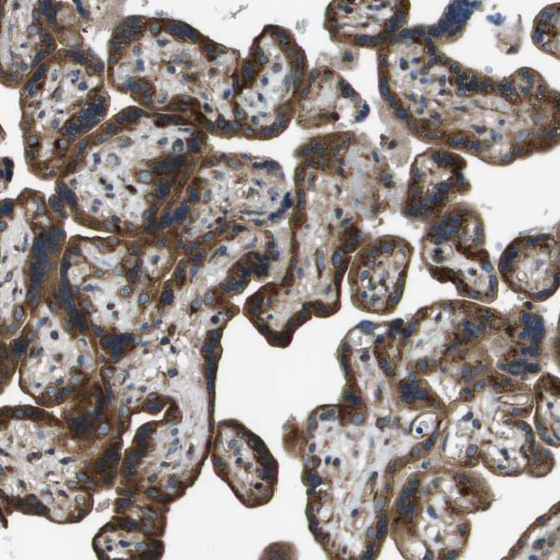 Immunohistochemistry-Paraffin ARFGAP2 Antibody - BSA Free