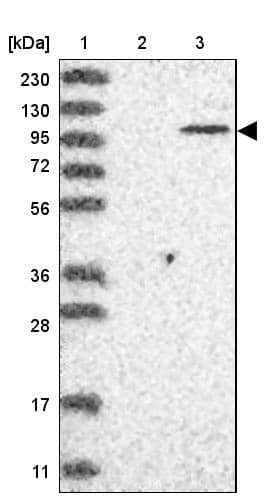 Lane 1: Marker [kDa] 230, 130, 95, 72, 56, 36, 28, 17, 11Lane 2: Human cell line RT-4Lane 3: Human cell line U-251MG sp