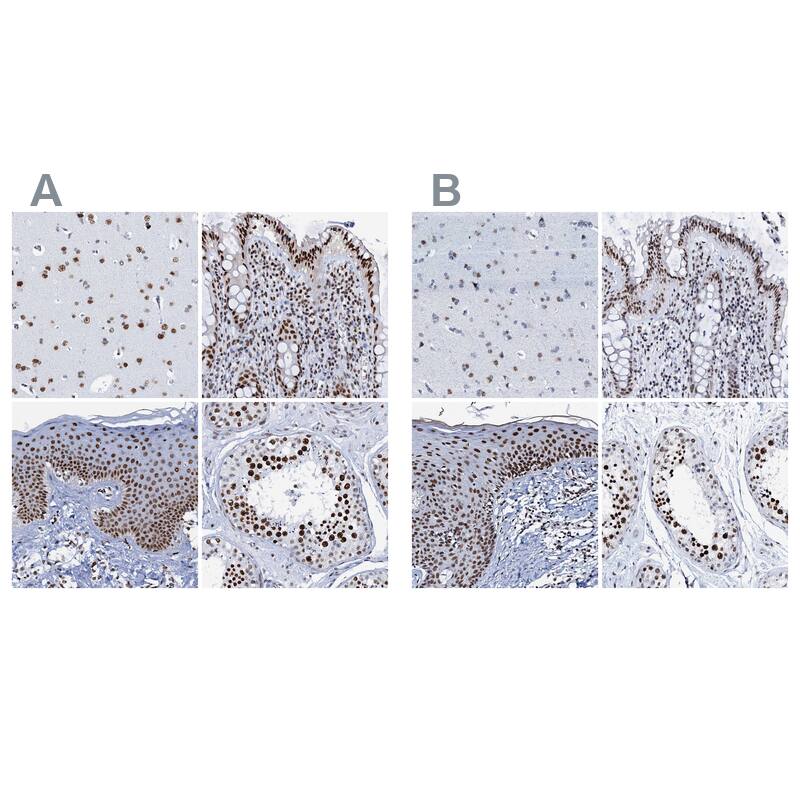 Staining of human rectum shows strong nuclear positivity in glandular cells.