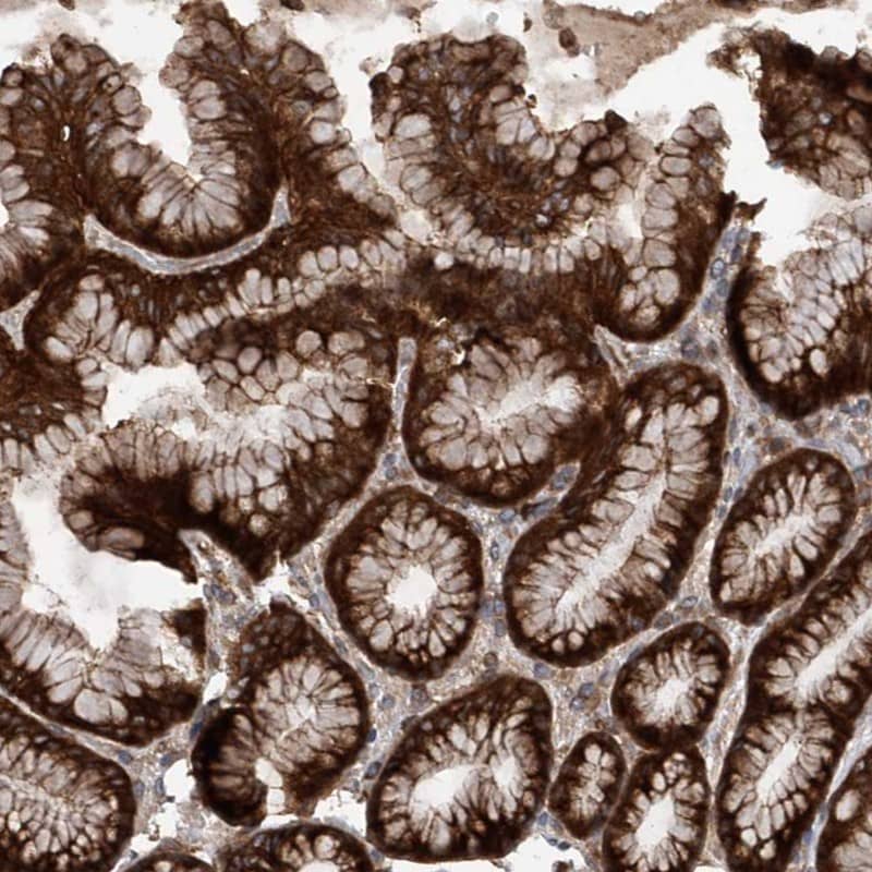 Staining of human stomach shows strong cytoplasmic positivity in glandular cells.