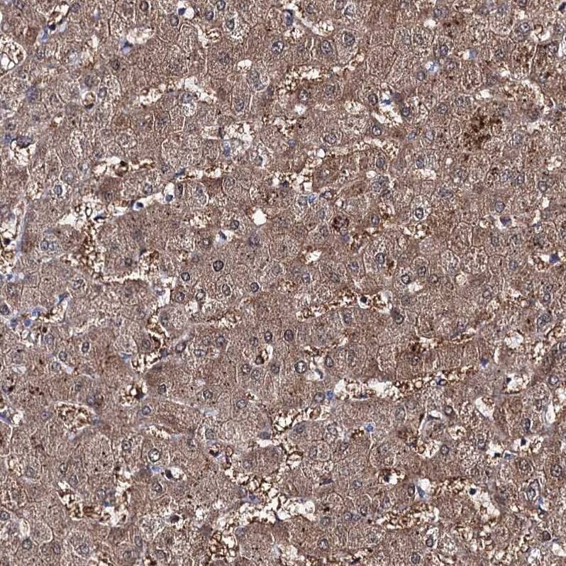 Staining of human liver shows moderate granular cytoplasmic positivity in hepatocytes.