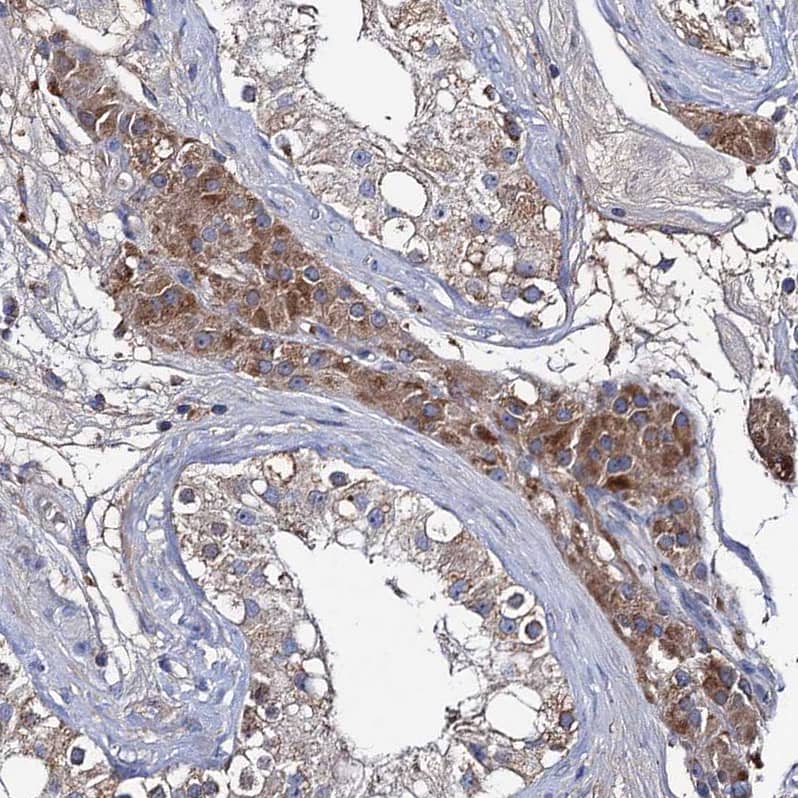 Staining of human testis shows moderate granular cytoplasmic positivity in Leydig cells.