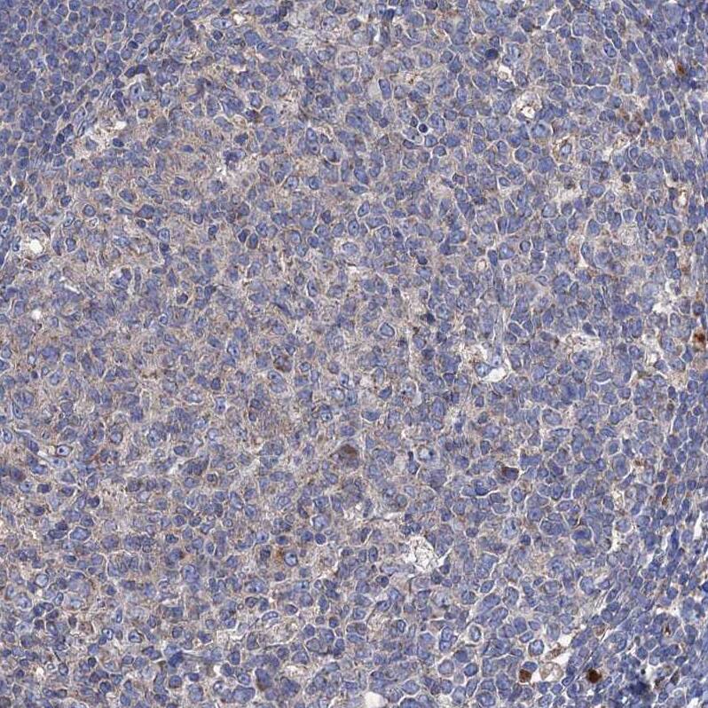 Staining of human tonsil shows very weak positivity in germinal center cells as expected.