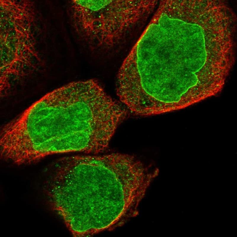 Staining of human cell line A-431 shows localization to nucleus & nuclear membrane.