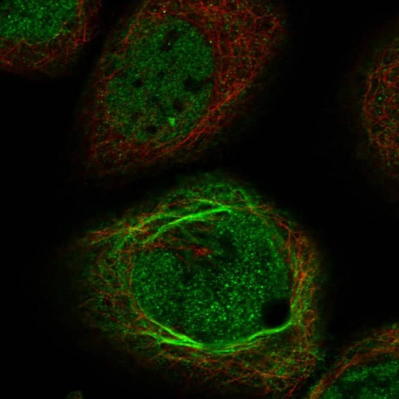 Immunocytochemistry/ Immunofluorescence QTRTD1 Antibody - BSA Free