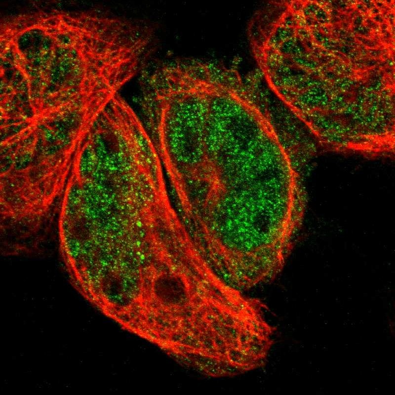 Immunocytochemistry/ Immunofluorescence ABHD4 Antibody - BSA Free