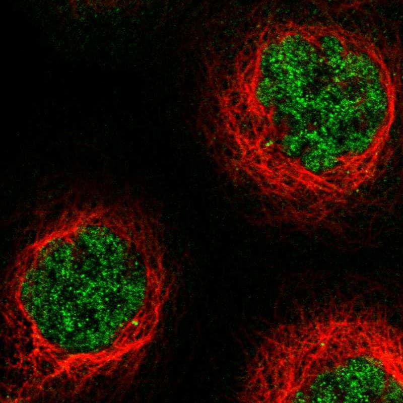 Staining of human cell line A-431 shows localization to nucleoplasm.