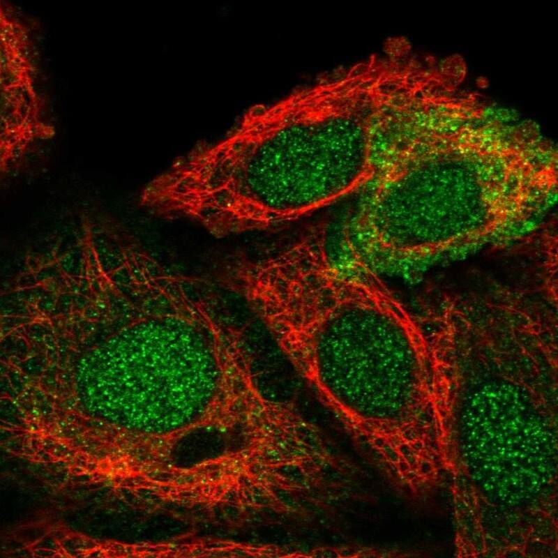 Staining of human cell line A549 shows localization to nucleus & cytosol.