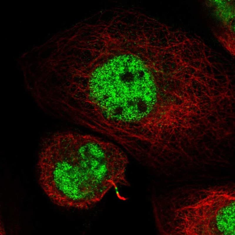 Staining of human cell line A-431 shows localization to nucleoplasm & cytokinetic bridge.