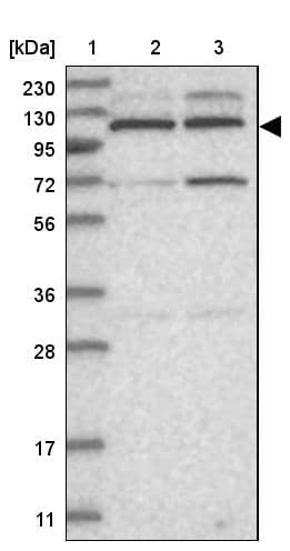 Lane 1: Marker [kDa] 230, 130, 95, 72, 56, 36, 28, 17, 11Lane 2: Human cell line RT-4Lane 3: Human cell line U-251MG sp