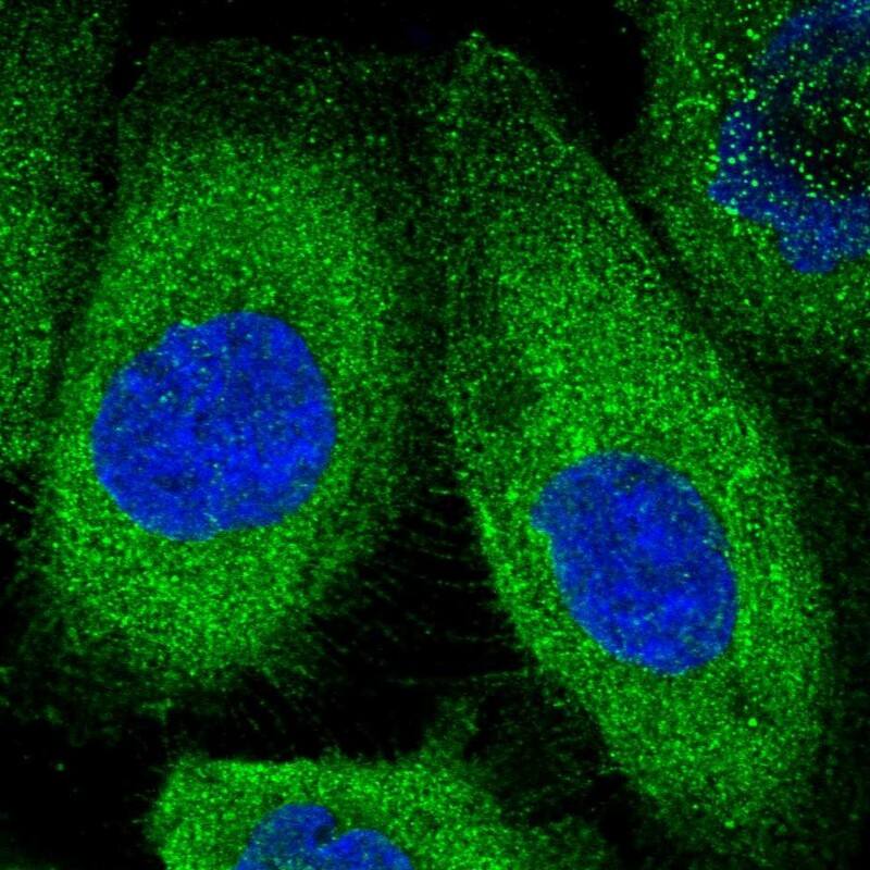 Staining of human cell line A-431 shows positivity in plasma membrane & cytoplasm.