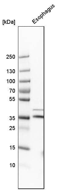 Analysis in human esophagus tissue.