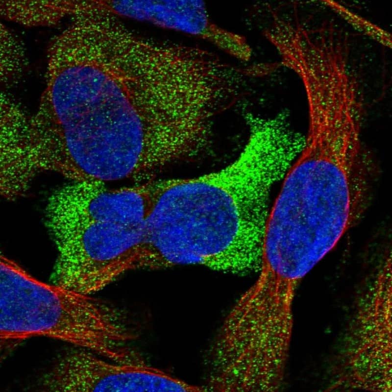 Immunocytochemistry/ Immunofluorescence GTDC1 Antibody - BSA Free