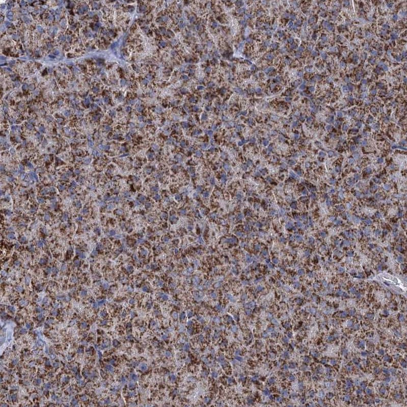 Immunohistochemistry-Paraffin ABHD10 Antibody - BSA Free