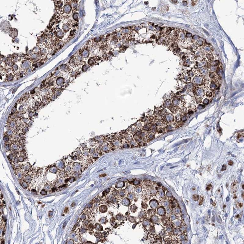 Staining of human testis shows strong granular cytoplasmic positivity in seminiferous ducts.