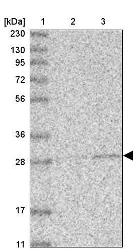 Lane 1: Marker [kDa] 230, 130, 95, 72, 56, 36, 28, 17, 11Lane 2: Human cell line RT-4Lane 3: Human cell line U-251MG sp