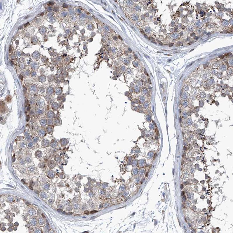 Immunohistochemistry-Paraffin USP48 Antibody - BSA Free