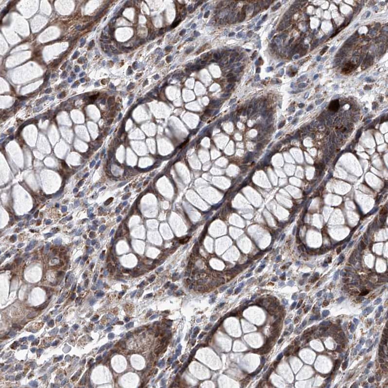 Immunohistochemistry-Paraffin USP48 Antibody - BSA Free