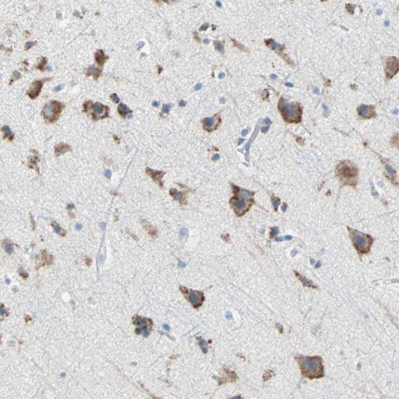 Staining of human cerebral cortex shows strong cytoplasmic positivity in neurons.