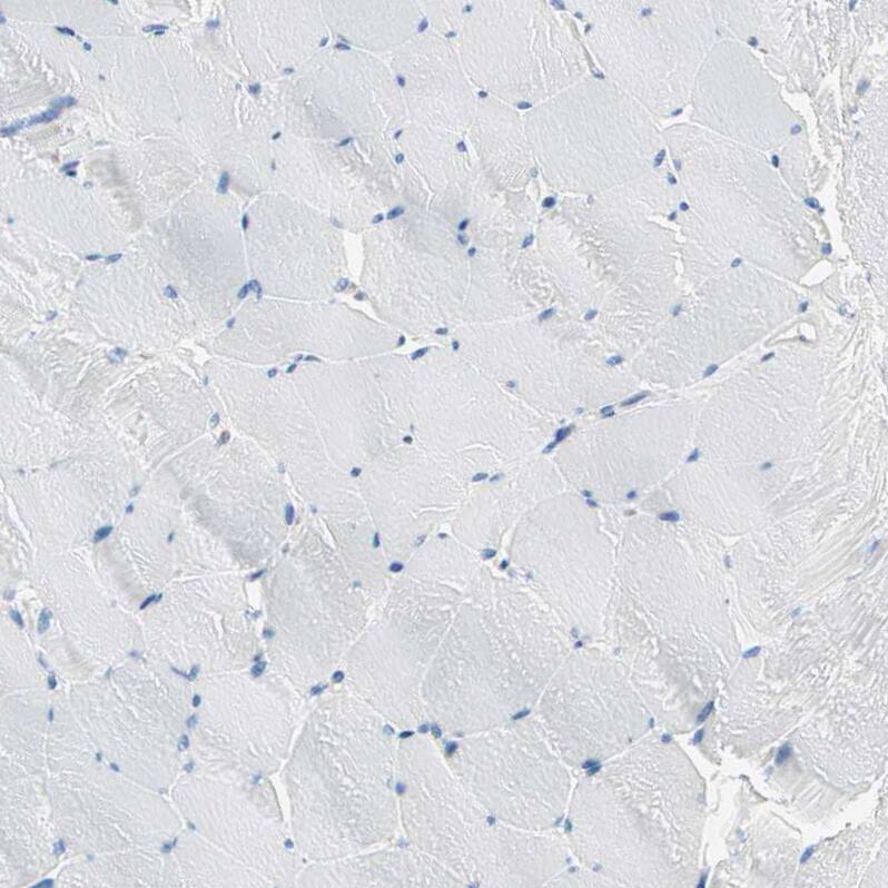 Staining of human skeletal muscle shows no positivity in myocytes as expected.