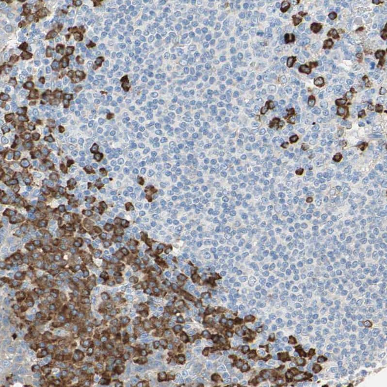 Staining of human tonsil shows strong cytoplasmic positivity in germinal and non-germinal center cells).