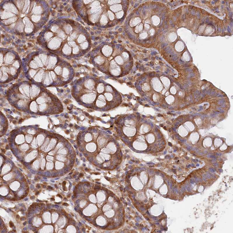 Immunohistochemistry-Paraffin LSG1 Antibody - BSA Free