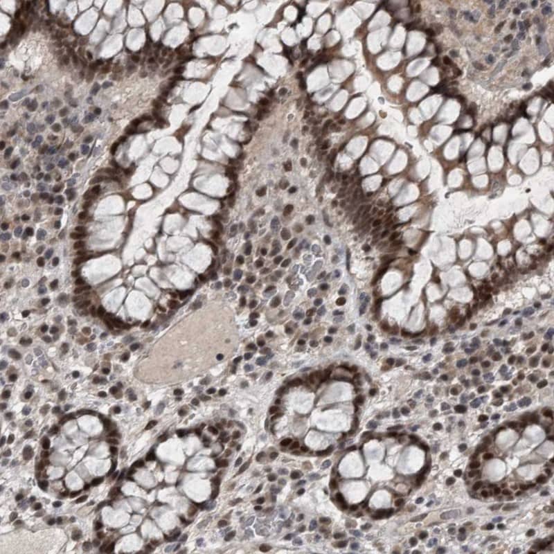 Staining of human colon shows strong nuclear positivity in glandular cells).