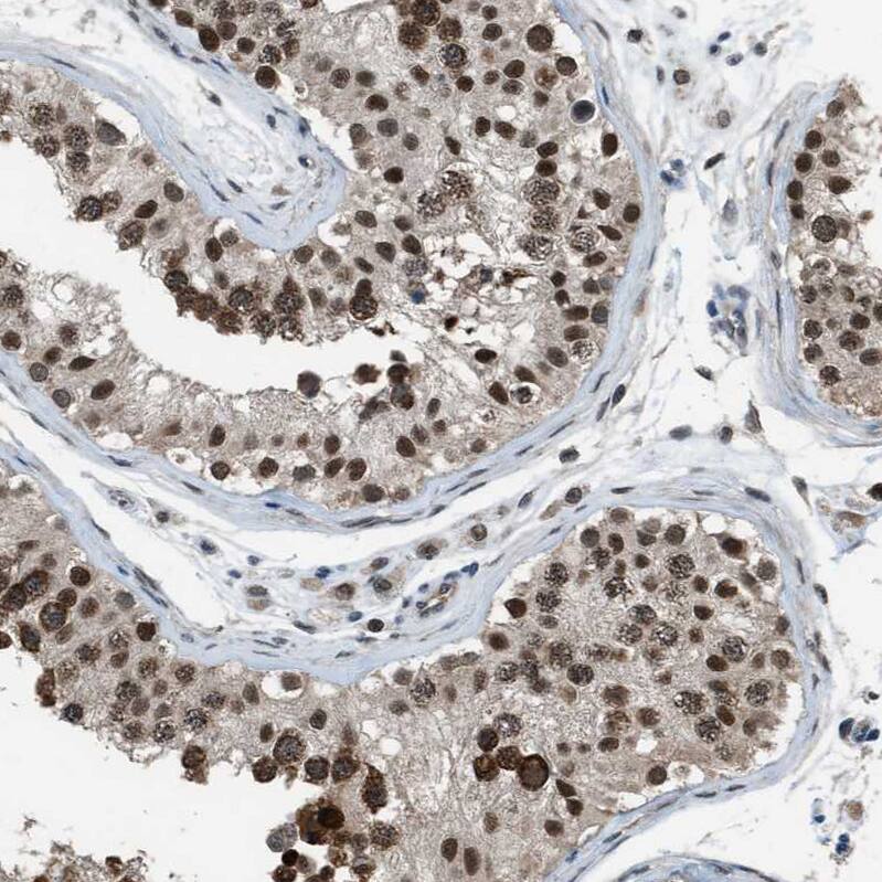 Staining of human testis shows moderate to strong nuclear and cytoplasmic positivity in cells in seminiferous ducts.